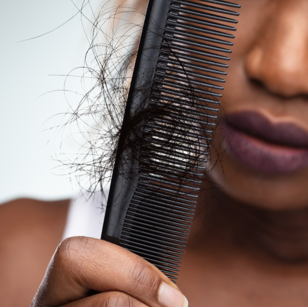 Medical Wigs: What You Need to Know about Wigs for Hair Loss