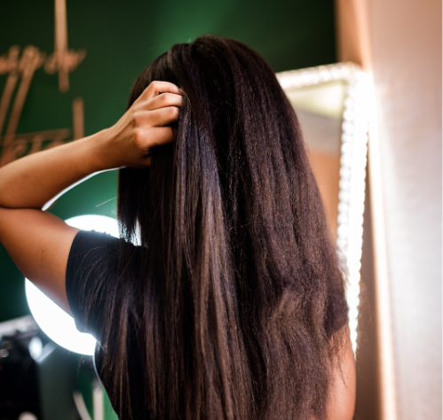 Dandruff & Wigs: How to Manage Flaky Scalp While Wearing Lace Front Wigs
